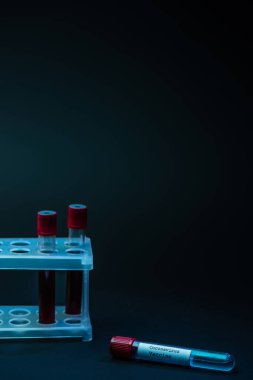 Test tüpü rafının yanında Coronavirus aşısı ve koyu arkaplanda kan örnekleri var.