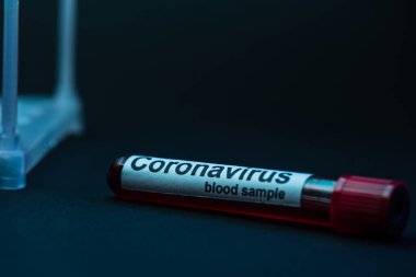 Koyu renk üzerinde koronavirüs kan örneği olan örnek tüpünün seçmeli odak noktası