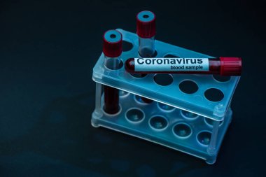 Koyu renk test tüplerindeki koronavirüs kan örneklerinin olduğu yüksek açılı tüpler.