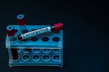 Koyu arkaplan üzerinde test tüpü rafında Coronavirus kan örnekleri bulunan örnek tüplerin yüksek açılı görüntüsü