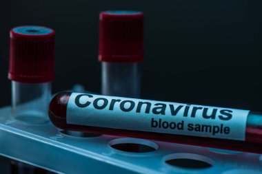 Koronavirüs kan örneği içeren örnek tüpünün seçmeli odak noktası koyu renkli test tüpü rafında.