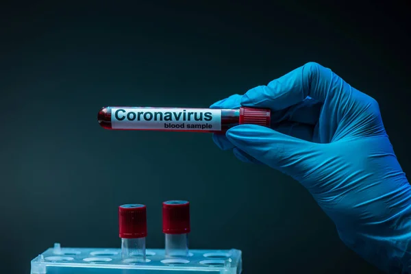 暗い背景にコロナウイルスの血液サンプルレタリングを持つ試験管を示す科学者の作物ビュー — ストック写真