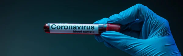 Horizontális Terménye Tudós Mutatja Kémcső Koronavírus Vérminta Felirattal Sötét Alapon — Stock Fotó