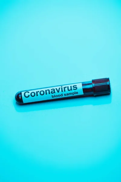 Mavi Üzerinde Koronavirüs Kan Örneği Olan Test Tüpünün Yüksek Açılı — Stok fotoğraf