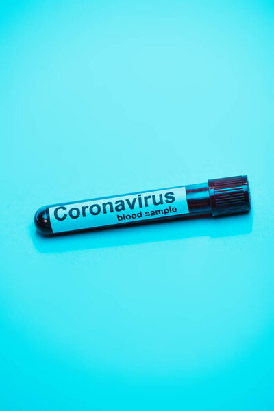 High angle view of test tube with coronavirus blood sample on blue