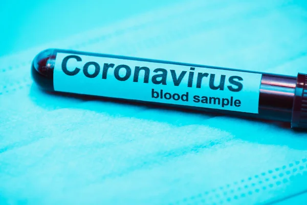 Tubo Ensayo Con Muestra Sangre Coronavirus Sobre Fondo Azul — Foto de Stock