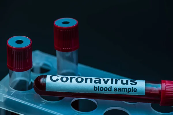 Prøveglas Med Coronavirus Blod Prøve Bogstaver Reagensglas Rack Mørk - Stock-foto