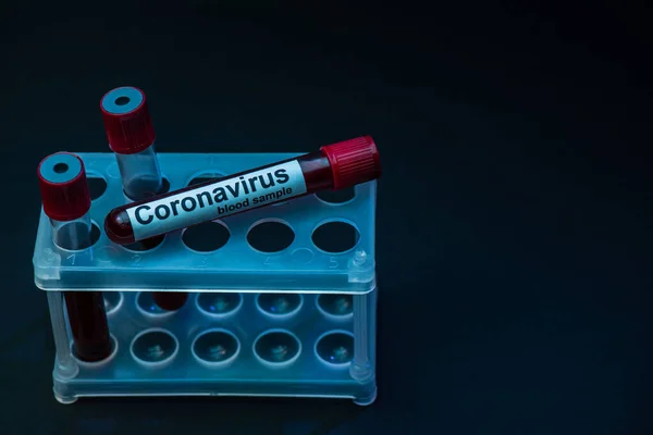 stock image High angle view of sample tubes with coronavirus blood samples in test tube rack on dark background
