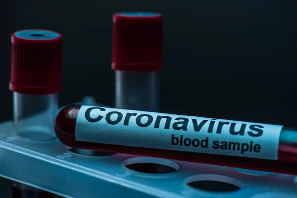 Selektiv Fokus Reagensglas Med Coronavirus Blod Prøve Bogstaver Reagensglas Rack - Stock-foto