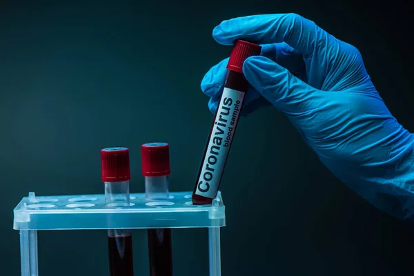 Обрезанный вид ученого, держащего трубку с образцом крови коронавируса, надпись возле стойки пробирки на тёмном фоне — стоковое фото