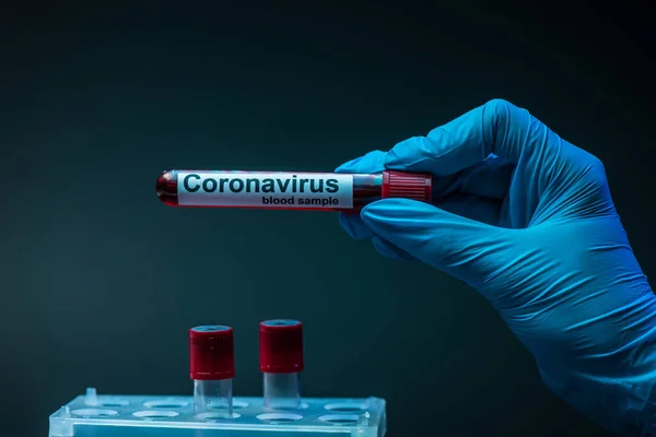 Cropped view of scientist showing test tube with coronavirus blood sample lettering on dark background — Stock Photo