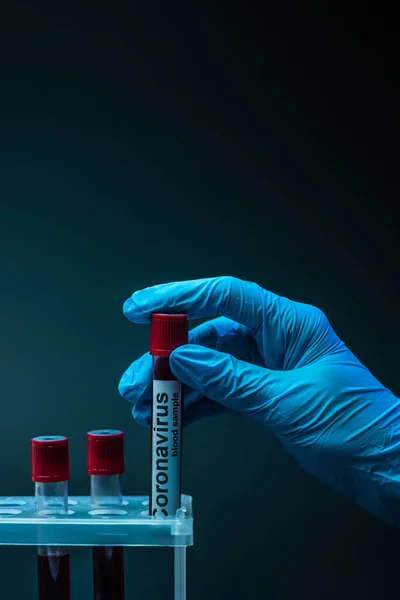 Partial view of scientist holding tube with coronavirus blood sample lettering near test tube rack on dark — Stock Photo