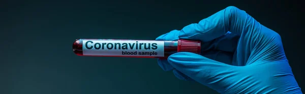 Horizontal crop of scientist showing test tube with coronavirus blood sample lettering on dark background — Stock Photo