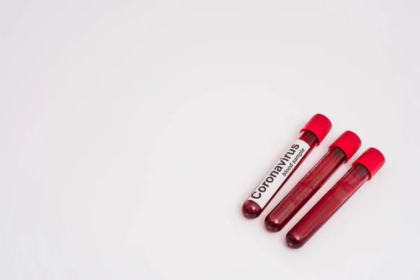 Vista de alto ângulo dos tubos de ensaio com amostras de sangue de coronavírus sobre fundo branco — Fotografia de Stock