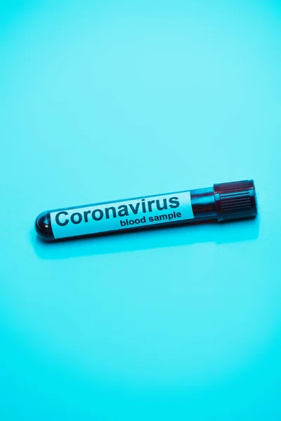 High angle view of test tube with coronavirus blood sample on blue — Stock Photo