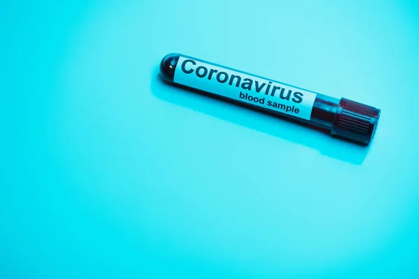 Vista de ángulo alto del tubo de ensayo con muestra de sangre de coronavirus sobre fondo azul - foto de stock