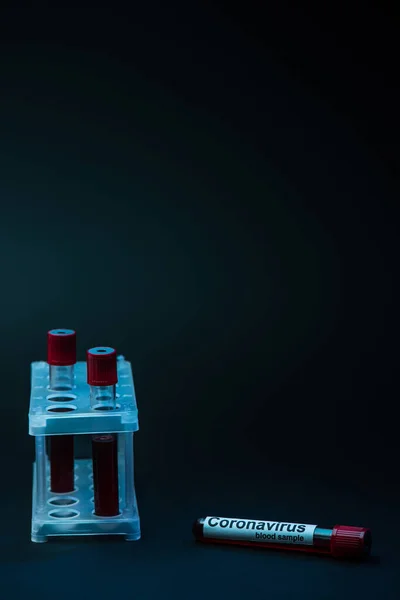 Образец коронавируса у стойки пробирки с трубками на тёмном фоне — стоковое фото