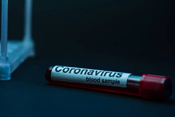 Enfoque selectivo del tubo de muestra con muestra de sangre de coronavirus en la oscuridad - foto de stock