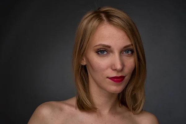 Close-up portrait of a young woman with acne skin problem on her face.