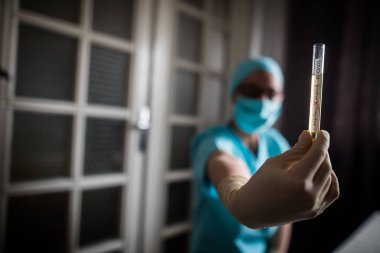 Coronavirus (COVID-19) için pozitif örneklerle birlikte bir doktorun ellerinin bir deney tüpünü tutarken ve ona bakarken kavramsal fotoğrafı (COVID-19).