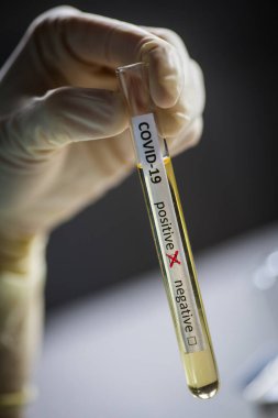 Coronavirus (COVID-19) için pozitif örneklerle birlikte bir doktorun ellerinin bir deney tüpünü tutarken ve ona bakarken kavramsal fotoğrafı (COVID-19).