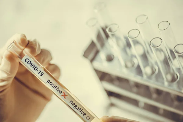 Fotografia Concettuale Delle Mani Medico Che Tiene Guarda Una Provetta — Foto Stock