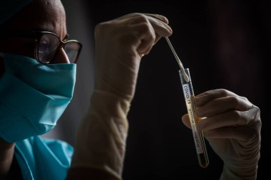 Coronavirus (COVID-19) testi sırasında bir doktorun elinde tuttuğu ve tüpe baktığı kavramsal fotoğraf).