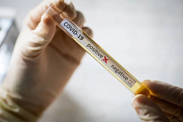 Fotografia Concettuale Delle Mani Medico Che Tiene Guarda Una Provetta — Foto Stock