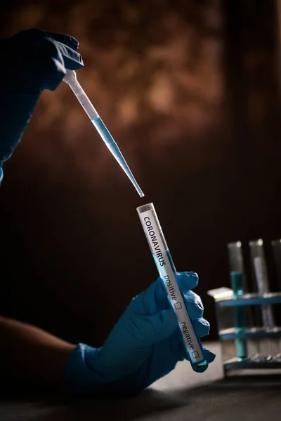 Fotografía Conceptual Médico Tomando Muestras Tubo Ensayo Con Una Pipeta — Foto de Stock