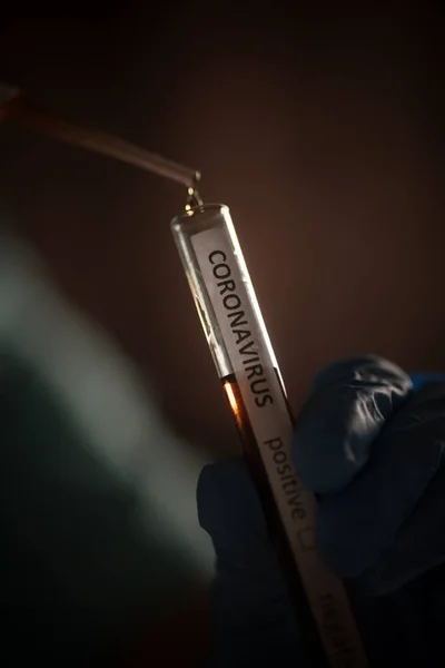 Coronavirus Covid Testi Sırasında Bir Doktorun Deney Tüpünden Pipetle Numune — Stok fotoğraf