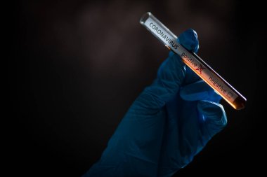 Coronavirus (COVID-19) için pozitif örneklerle birlikte bir doktorun ellerinin bir deney tüpünü tutarken ve ona bakarken kavramsal fotoğrafı (COVID-19).