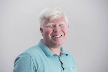 Albino genç adam portresi. Sarışın adam beyaz arka plan izole. Albinizm, soluk deri.