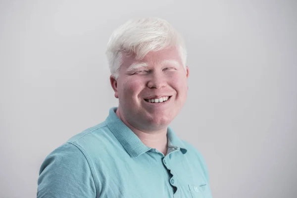 Retrato de un joven albino. Tipo rubio aislado en el fondo blanco. Albinismo, piel pálida . —  Fotos de Stock