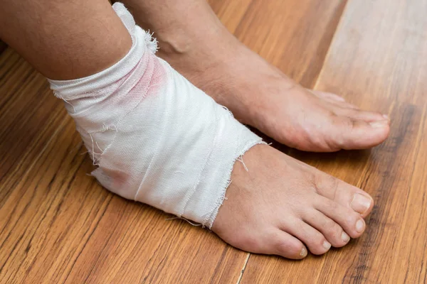 Lady with a wrapped foot on floor — Stock Photo, Image