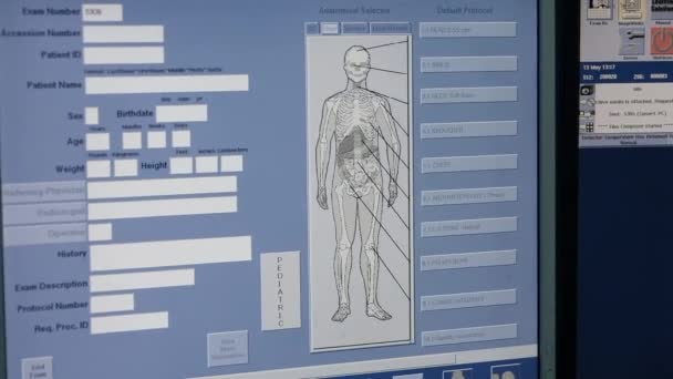 Как выглядит человеческое легкое с ковидом-19 — стоковое видео