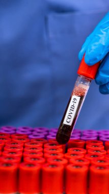 Laboratuvarda Covid-19 'u elle kontrol et.