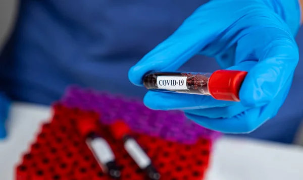 Laboratuvarda Covid-19 'u elle kontrol et.