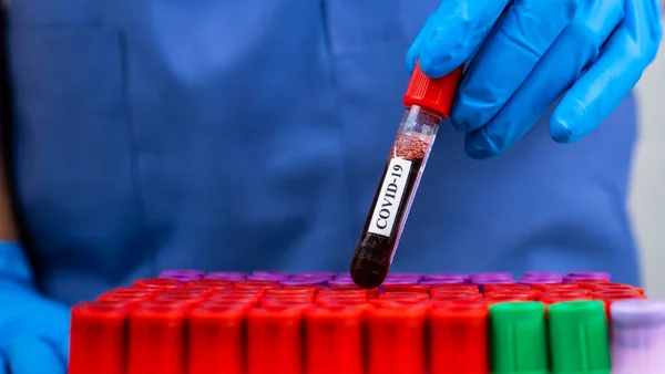 Laboratuvarda Covid-19 'u elle kontrol et.