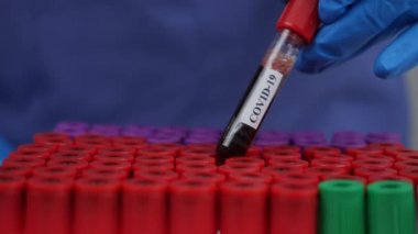 Laboratuvarda kovid 19 testi için test tüpünde kan tutan bir araştırmacı var.