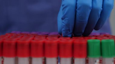 Laboratuvarda kovid 19 testi için test tüpünde kan tutan bir araştırmacı var.