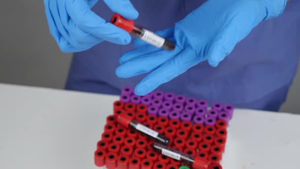 Pesquisador Segurando Sangue Tubo Teste Para Verificar Covid Laboratório — Vídeo de Stock