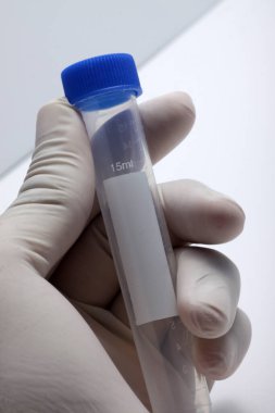 Tıbbi şırınga ve test tüpünü yakın plan beyaz arka planda izole edilmiş laboratuvar test amacıyla çek.