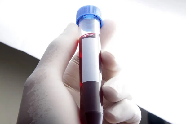 Blood Sample Patient Placed Test Tube Analyzing Testing Laboratoty — Stock Photo, Image