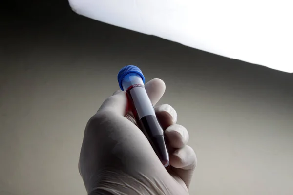 Muestra Sangre Del Paciente Colocada Tubo Ensayo Para Analizar Analizar —  Fotos de Stock