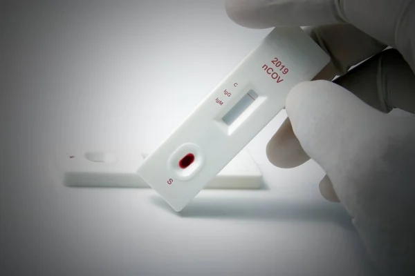 2019 nCOV rapid test kit, used for screening from SARS CoV 2 viruses that cause COVID 19 / Wuhan Pneumonia