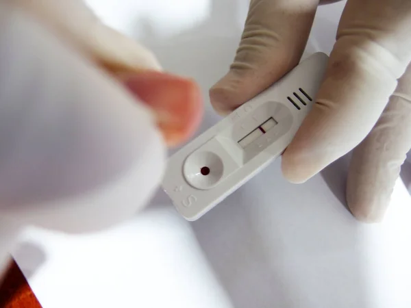 2019 Coronavirus Schnelltest Mit Blutprobe Zur Früherkennung Von Ncov Viren — Stockfoto