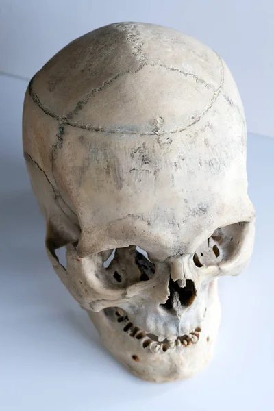 Anatomia humana. O crânio humano. Vista superior, vista lateral . — Fotografia de Stock