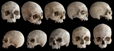 İnsan anatomisi. Çenesiz bir insan kafatası. Kafatasının dönüşlerinin toplanması. Kafatası farklı açılarda. Siyah arkaplanda izole.