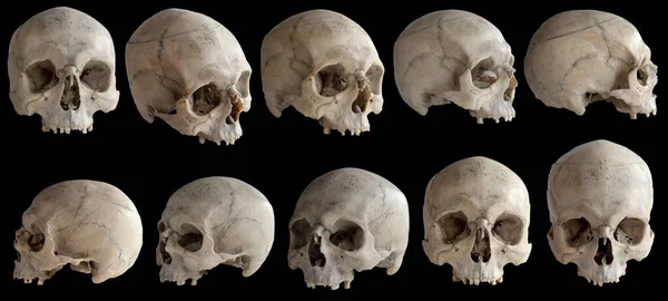 解剖学だ 顎のない人間の頭蓋骨 頭蓋骨の回転のコレクション 異なる角度で頭蓋骨 黒の背景に隔離された — ストック写真
