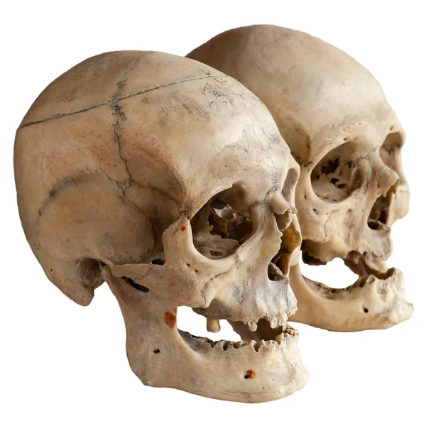 Two Human Skulls Isolated White Close — Stock Photo, Image